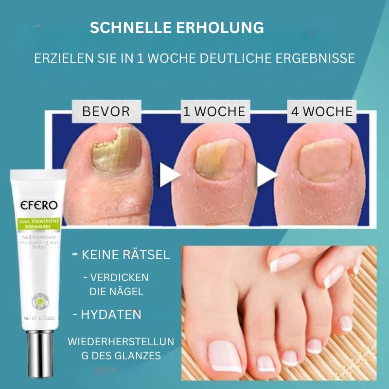 NailRenew - Schnelle Nagelreparaturbehandlung für stärkere und gesündere Nägel | 1+1 Gratis