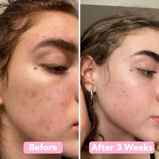 FrischAura - Strahlender Glow-Reiniger mit integriertem Silikon-Peelingbürstchen