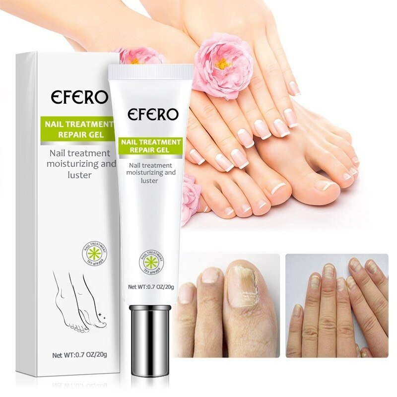 NailRenew - Schnelle Nagelreparaturbehandlung für stärkere und gesündere Nägel | 1+1 Gratis