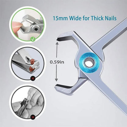 NailMate – Professioneller Nagelknipser für sanftes und präzises Kürzen