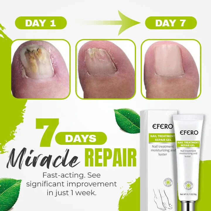 1+1 Gratis | Nagelpilz-Behandlungsgel | Klinische Wirkung | Repariert & Stärkt Nägel | Für Zuhause & Unter Nagellack