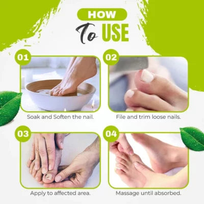 1+1 Gratis | Nagelpilz-Behandlungsgel | Klinische Wirkung | Repariert & Stärkt Nägel | Für Zuhause & Unter Nagellack
