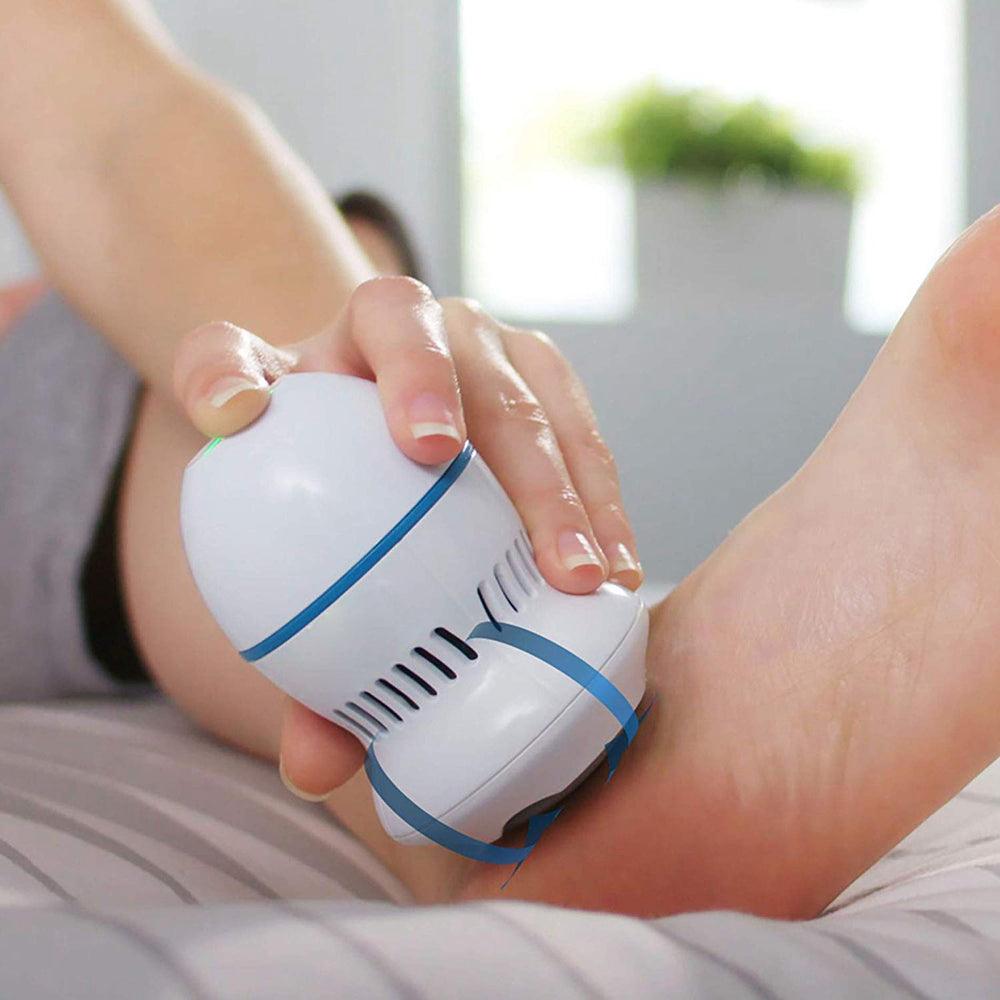 SoftStep – Elektrischer Hornhautentferner für glatte, schöne Füße
