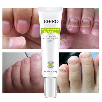 NailRenew - Schnelle Nagelreparaturbehandlung für stärkere und gesündere Nägel | 1+1 Gratis