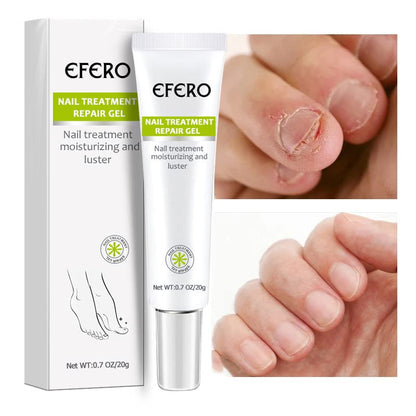 NailRenew - Schnelle Nagelreparaturbehandlung für stärkere und gesündere Nägel | 1+1 Gratis