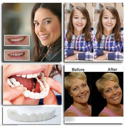 1+1 Gratis | SnapSmiles™ Aufsteckprothesen