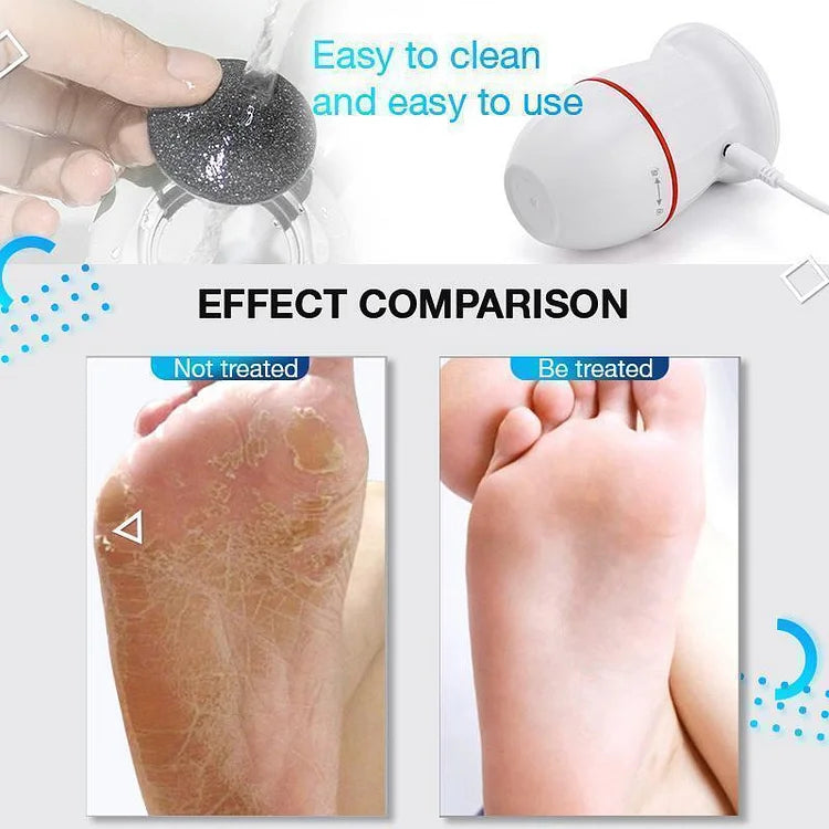 SlikFeet™ - Elektrischer Vakuum-Adsorptions-Fußschleifer