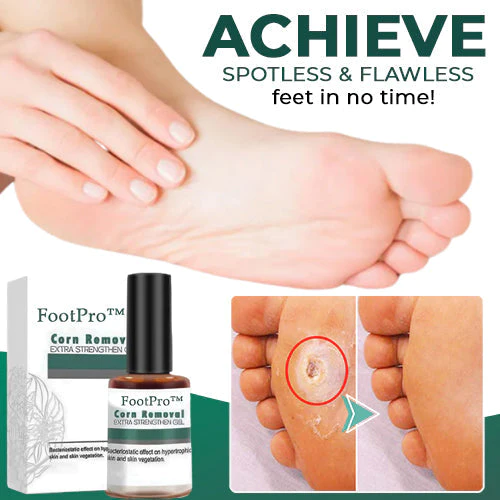 1+1 Gratis | FootPro™ Hühneraugenentfernung Extra-Stärke-Gel