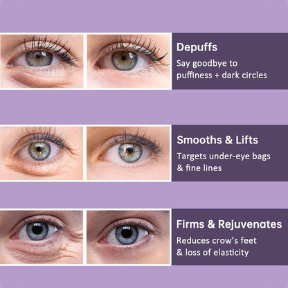 YouthEyes – Straffende Augencreme für glattere, strahlendere und geliftete Augen