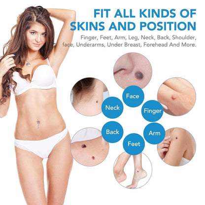 FlawFix™ | Stielwarzen Entfernungsset