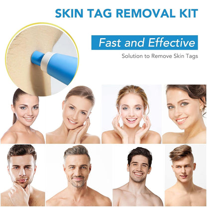 FlawFix™ | Stielwarzen Entfernungsset