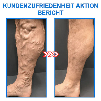 SlimFlex – Ionische Body Shaping Stretch-Socken für Gesundheit und Erleichterung