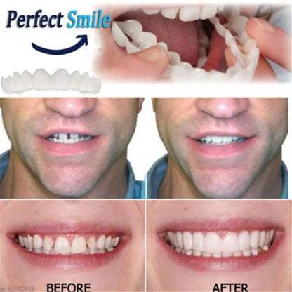 1+1 Gratis | SnapSmiles™ Aufsteckprothesen
