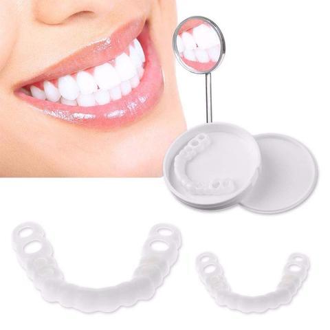 1+1 Gratis | SnapSmiles™ Aufsteckprothesen