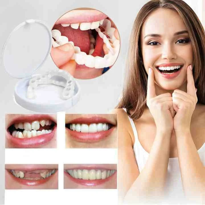 1+1 Gratis | SnapSmiles™ Aufsteckprothesen