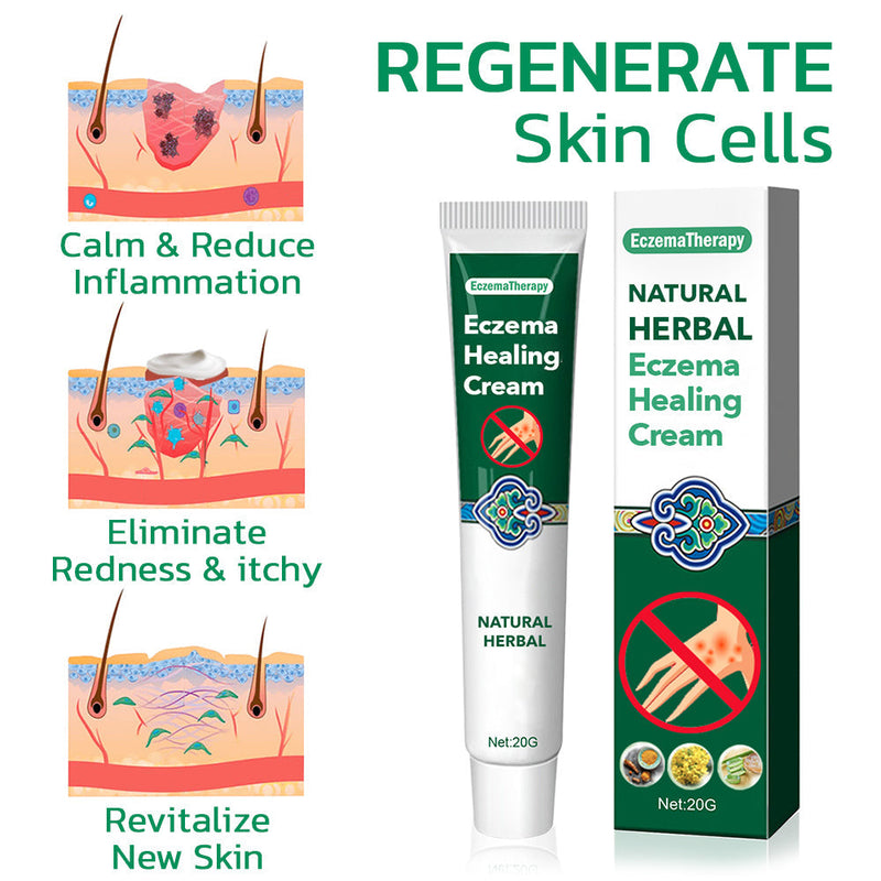 1+1 Gratis | Ekzemcreme | Pflanzlich & Reizlindernd | Stärkt Hautbarriere | Mit Kurkuma & Aloe Vera