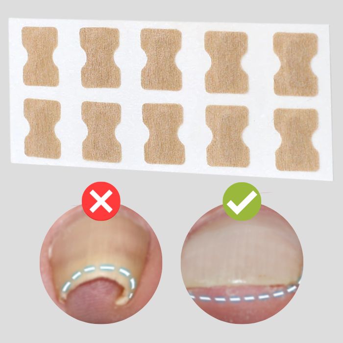 FinePatches – Korrekturpflaster für schöne und gesunde Nägel