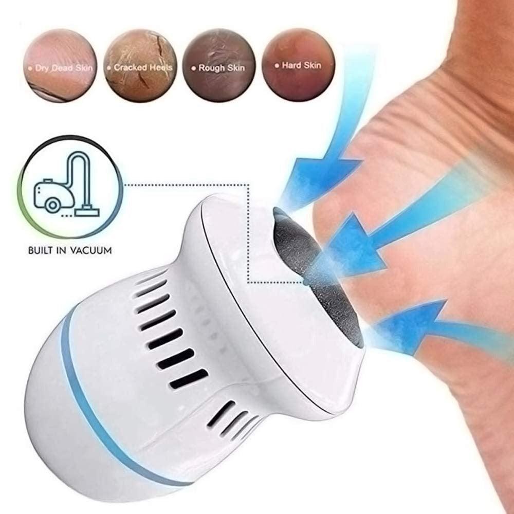 SoftStep – Elektrischer Hornhautentferner für glatte, schöne Füße