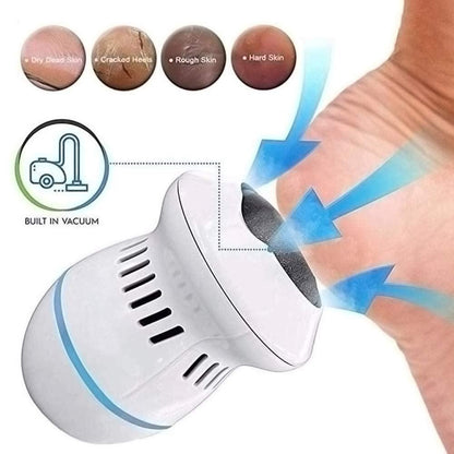 SoftStep – Elektrischer Hornhautentferner für glatte, schöne Füße