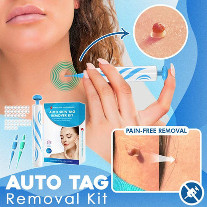 FlawFix™ | Stielwarzen Entfernungsset