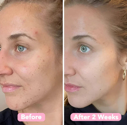 FrischAura -  Strahlender Glow-Reiniger mit integriertem Silikon-Peelingbürstchen