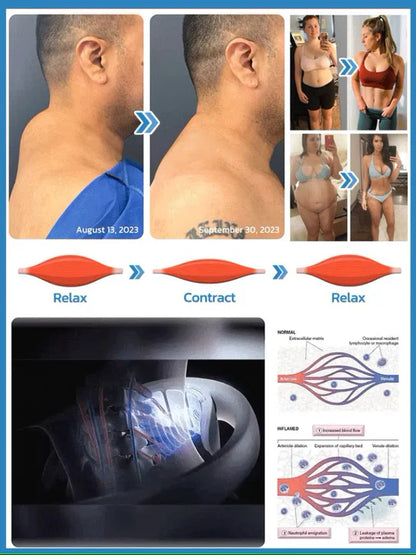 Vitalize™ – Nicht-invasive Fettreduzierung