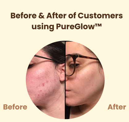 PureGlow™ – Lösung für strahlende Haut