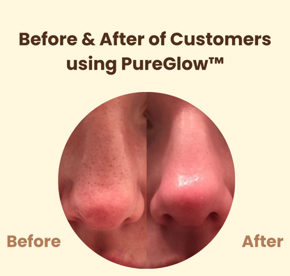 PureGlow™ – Lösung für strahlende Haut