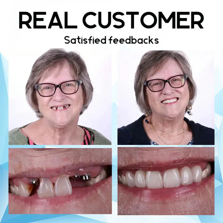 SmilePro™ – Schnapp-Prothesen