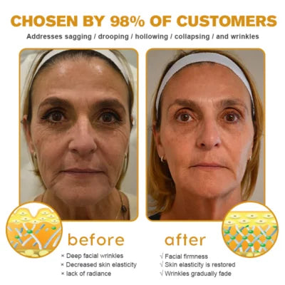 1+1 Gratis | AeroBripe™ Ultimatives Anti-Aging