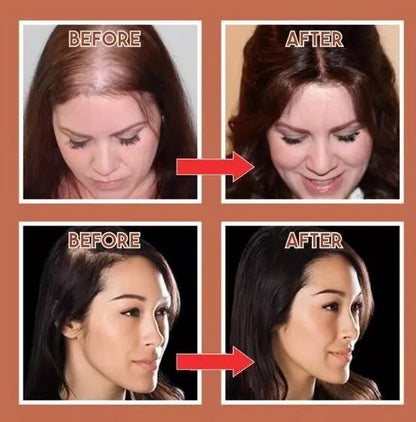 MagicHair – Topper-Clip für natürlich aussehende Haarabdeckung