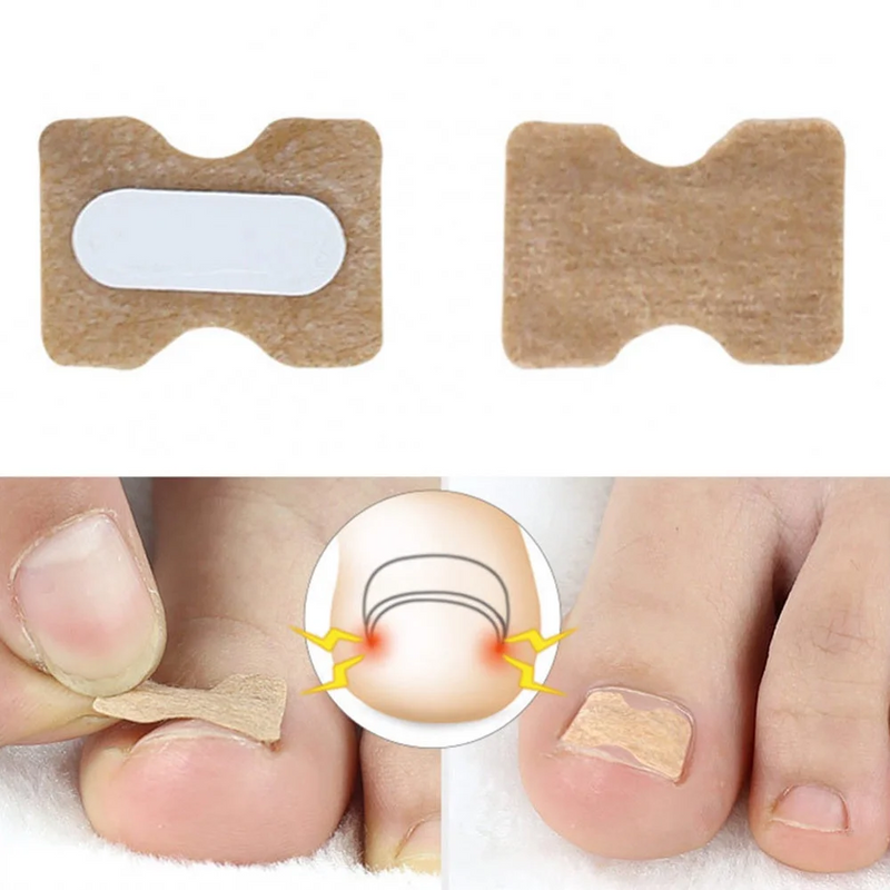 1+1 Gratis | Klebefreies Zehennagelpflaster™ Reparieren Sie beschädigte Nägel