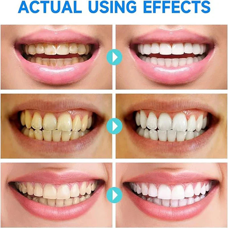 BrightDent – Sanfte Whitening Zahnpast für gesunde und saubere Zähne
