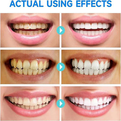 BrightDent – Sanfte Whitening Zahnpast für gesunde und saubere Zähne