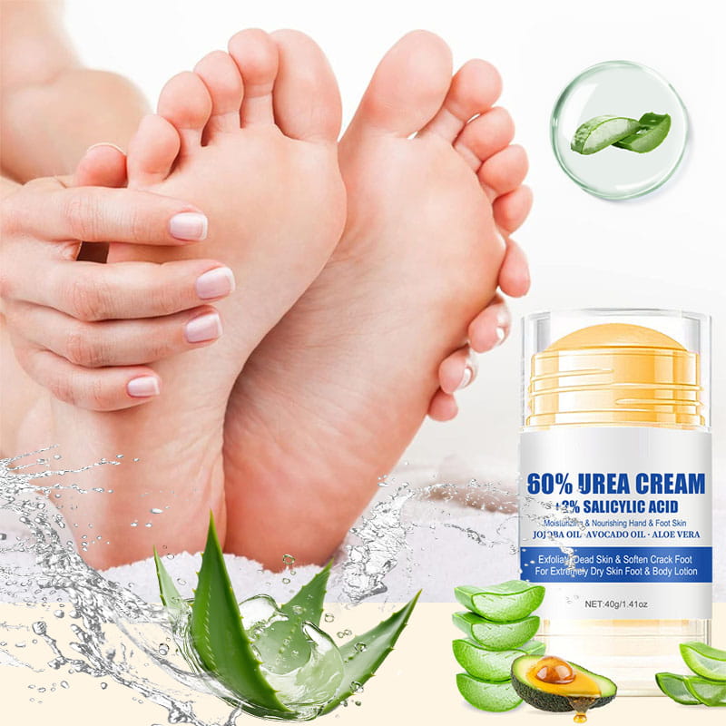 SoftStep – Feuchtigkeitsspendende Fußcreme für trockene und rissige Fersen