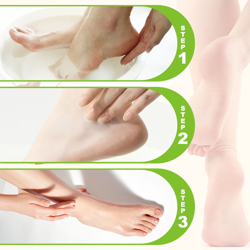SoftStep – Feuchtigkeitsspendende Fußcreme für trockene und rissige Fersen
