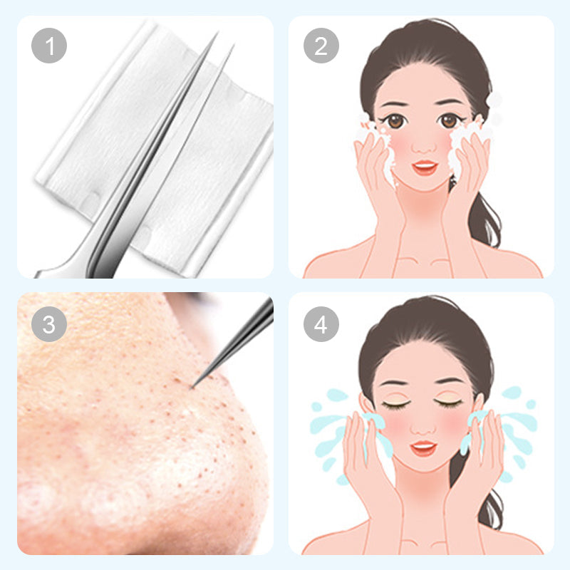 PoreMaster – Hygienic precision tool for blackhead removal