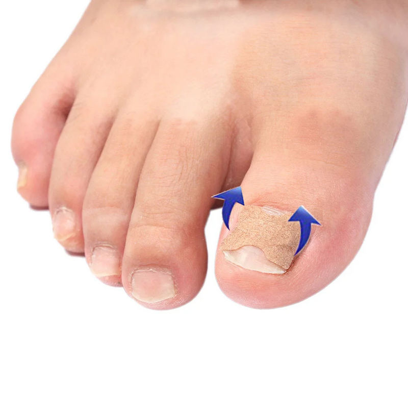 1+1 Gratis | Klebefreies Zehennagelpflaster™ Reparieren Sie beschädigte Nägel